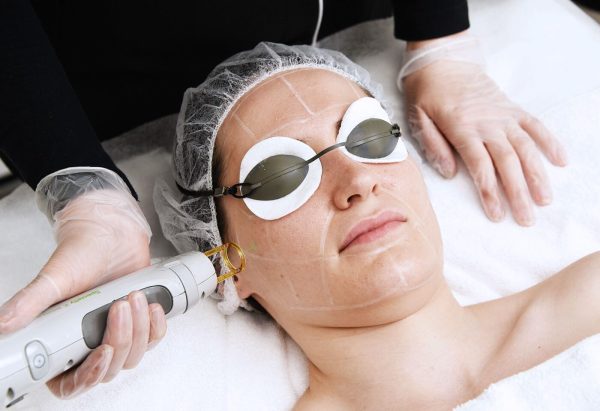 Acne Laser Facial